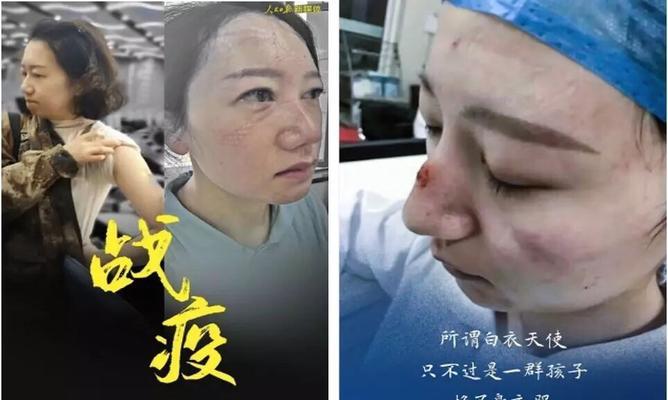 最美的逆行者（他们用生命守护希望）